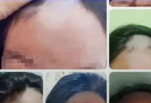 Guru Botaki Siswi SMP Lamongan, Kini Dinonaktifkan