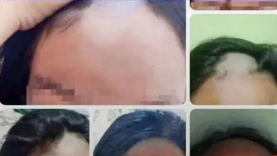 Guru Botaki Siswi SMP Lamongan, Kini Dinonaktifkan